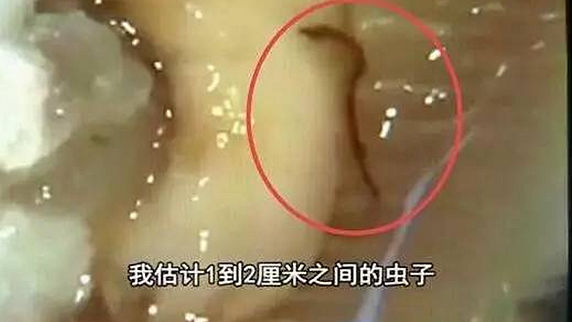 一只生蠔引起的冤案，觸動了餐飲人的“麻木神經(jīng)”